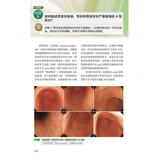【出版社直发】京都胃炎分类问答 春间贤 主编 可作为消化内科医生的参考书、工具书 9787559144980 辽宁科学技术出版社 商品图4