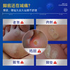 让脚部美观不再疼痛【Breathy鸡眼膏】长效生物膜保护技术，一次涂抹长久守护 商品缩略图1