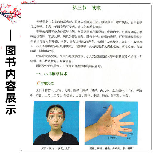 儿科实用中医适宜技术 戎萍 王小芸 杜春雁 主编 本书适合广大医务工作者及中医爱好者参阅使用 9787521457438中国医药科技出版社 商品图4
