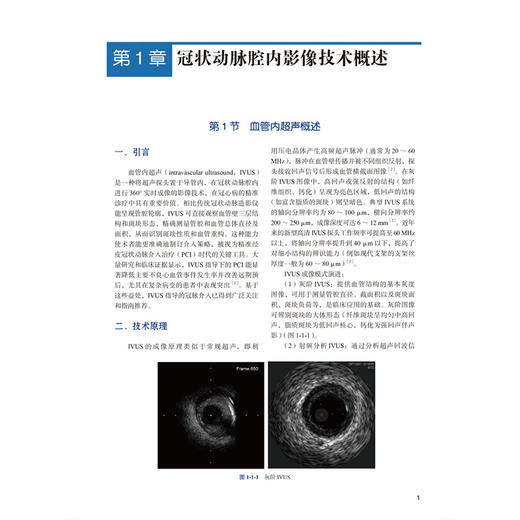 冠状动脉腔内影像技术与介入治疗 心血管介入前沿 葛均波 系统介绍血管内超声及光学相干断层成像的成像原理等 北京大学医学出版社 商品图4
