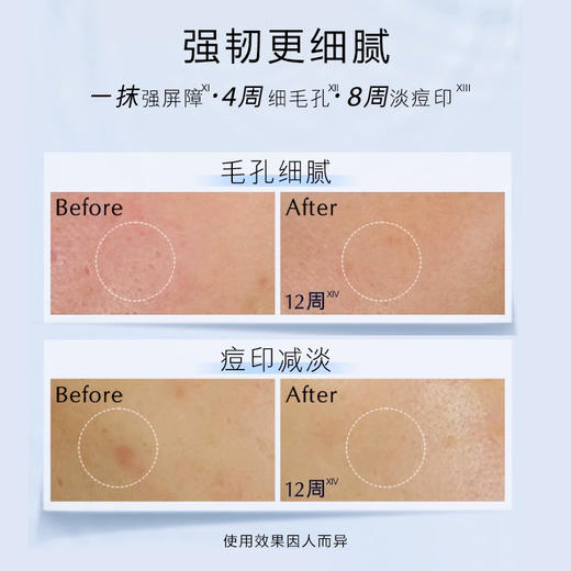 雅诗兰黛微精华露保湿修护舒缓控油细腻透亮精华水樱花水/原生液200ml+100ml*2 商品图2