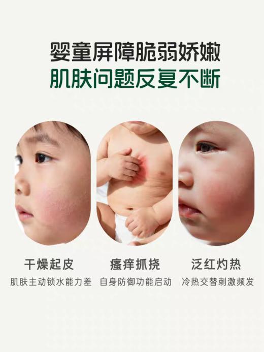 爱托Dr.ato7号  婴儿优护润肤霜160ml 商品图3
