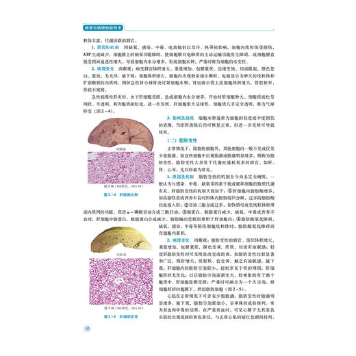 病理与病理检验技术 全国高职高专医学检验技术专业规划教材(第二轮) 马桂芳 周晓 主编 供医学检验技术专业用 中国医药科技出版社 商品图4