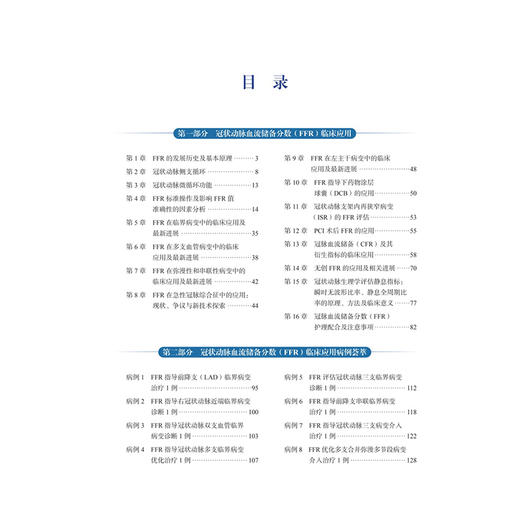 沿冠状动脉血流储备分数指导的介入治疗 心血管介入前 唐强 介绍冠状动脉血流储备分数操作规范和注意事项等 北京大学医学出版社 商品图3