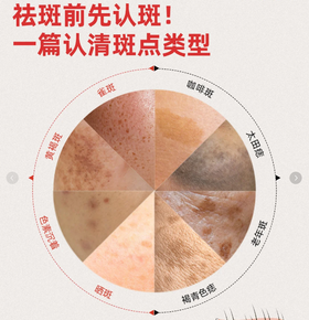 祛斑前先认斑！ 一篇认清斑点类型