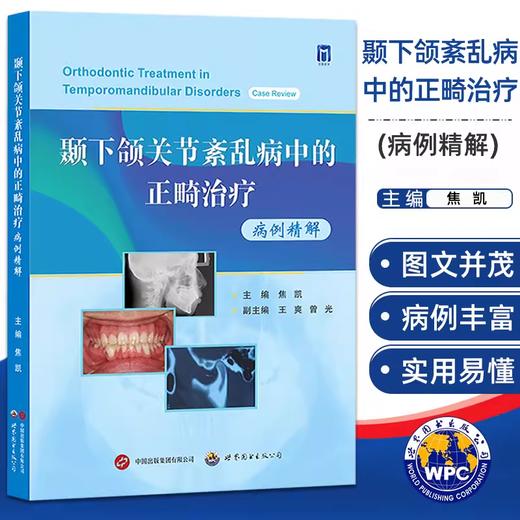 颞下颌关节紊乱病中的正畸治疗病例精解 商品图0