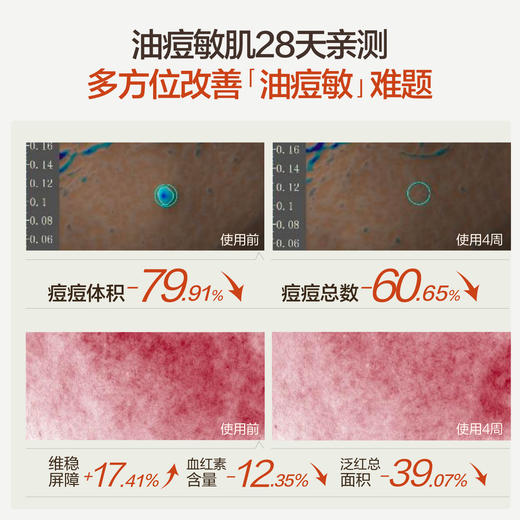 HBN净肤祛痘精华乳祛痘舒缓细毛孔精华乳 商品图2