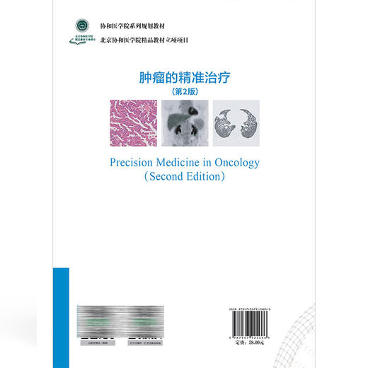 肿瘤的精准治疗 第2二版 王颖轶 肿瘤的精准预防 临床研究和方法设计 肿瘤分期与疗效评价 9787567924666中国协和医科大学出版社 商品图2