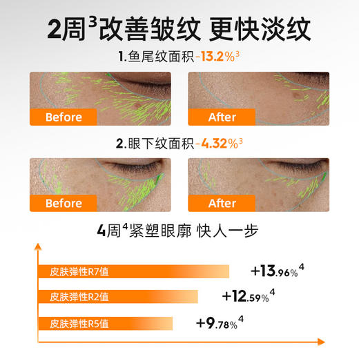 【99元3瓶】绽媄娅 贴骨pro眼霜 丰盈紧致淡纹精华眼霜 15g*3瓶 商品图1