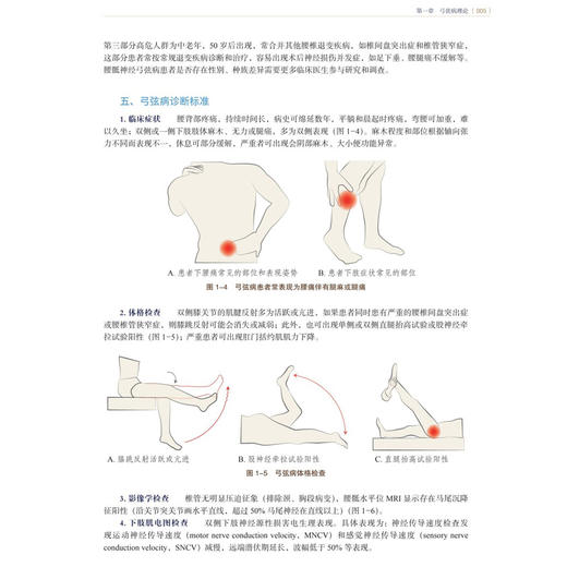 脊柱外科弓弦病理论与临床实践 史建刚 编著 本书涵盖颈椎、胸椎、腰椎等多个节段的常见与疑难病症及术后相关并发症 科学出版社 商品图4