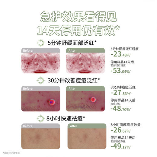 【青少年祛痘精华】无酸祛痘 修护痘损 袋鼠妈妈青少年安肌祛痘修护精华液15g 商品图1