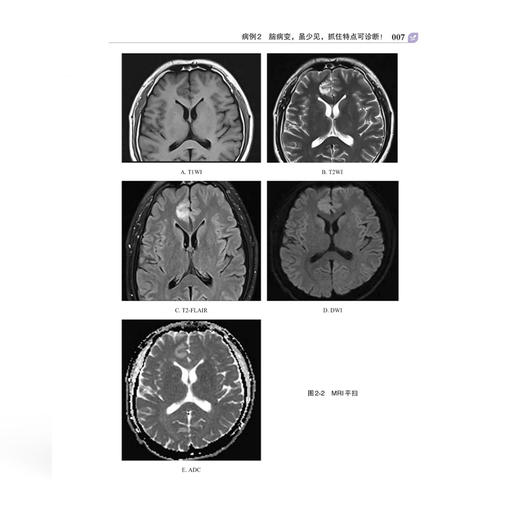 向子云丁香园影像读片精选100例 向子云 周洁 主编 影像诊断的实战图谱 常见病的诊断要点等 9787567928503中国协和医科大学出版社 商品图4