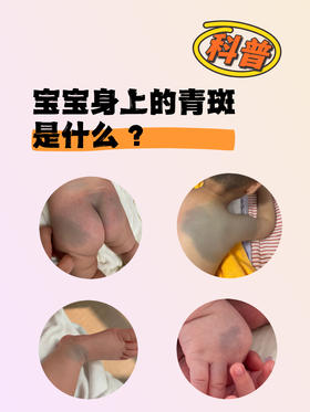 宝宝屁股有“乌青”到底是什么？会消失吗？