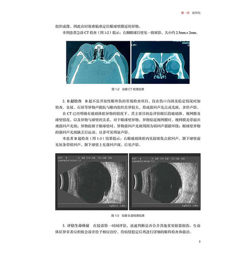 中山眼科急症临床病例解析 2025版（中山眼科疑难眼病系列）李涛 娄秉盛 主编 参考书 西医 眼科学 9787117393553 人民卫生出版社 商品图4