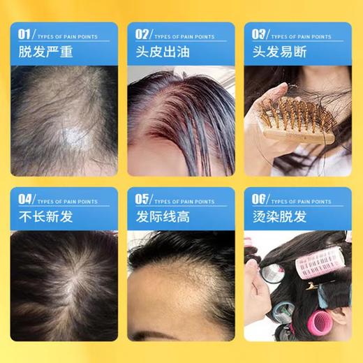 南京同仁堂防脱洗发水控油去屑蓬松防掉固护发老生姜洗发露 商品图2