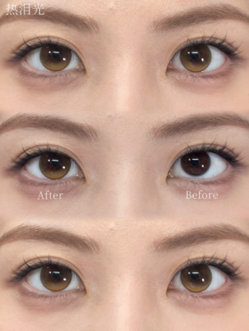 Kira fairy日抛美瞳 热泪光 14.5mm