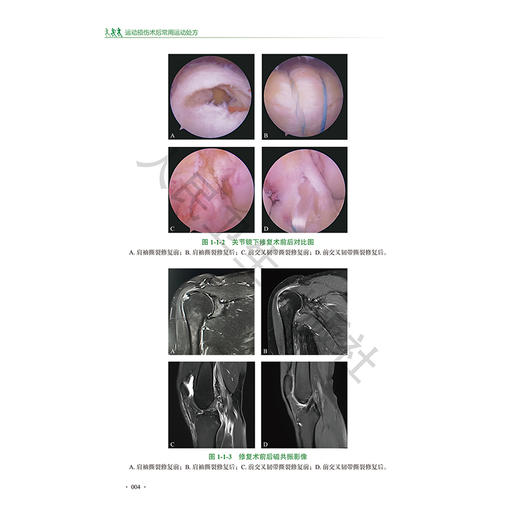 运动损伤术后常用运动处方 附视频 吕红斌 主编 本书的“居家锻炼”为医务人员和患者提供了基本的家庭自我康复方案人民卫生出版社 商品图4