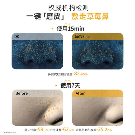 【青少年去黑头贴】无酸无痛温和去黑头 袋鼠妈妈双重净爽去黑头组合 商品图4