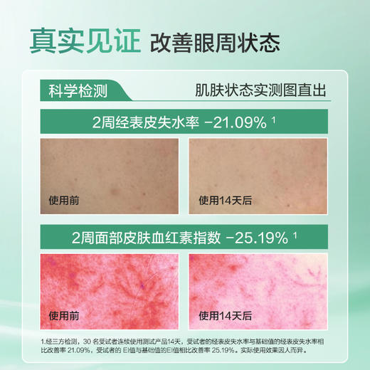 【2盒更划算】珍视明多效修护凝胶护眼贴5片/盒 商品图3