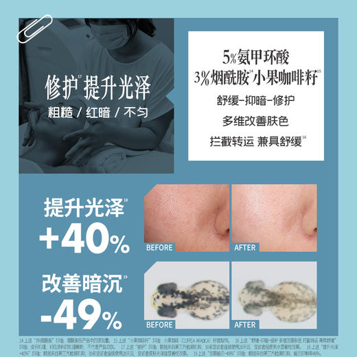 【混知推荐】言之有物 5%氨甲环酸喷雾 商品图2