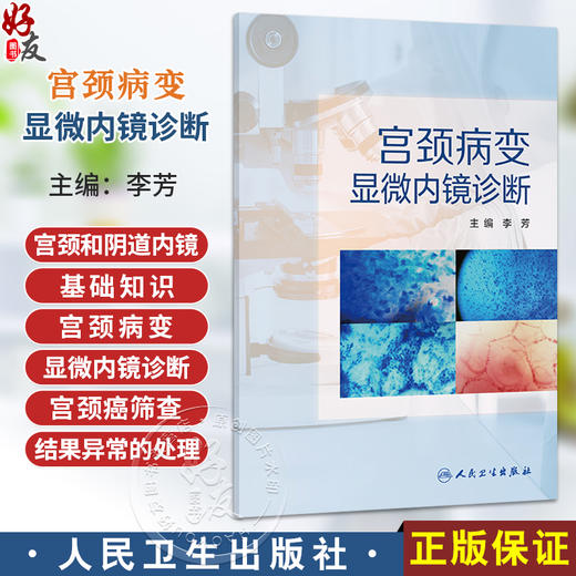 宫颈病变显微内镜诊断 李芳 主编 宫颈和阴道内镜的基础知识 宫颈病变的显微内镜诊断 宫颈癌筛查结果异常的处理等人民卫生出版社 商品图0