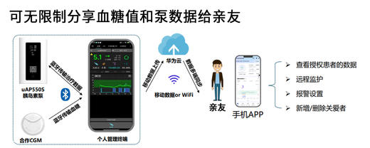 闭环泵闭环胰岛素泵全自动泵蓝牙泵智能精准控糖上门培训咨询客服有惊喜 商品图3