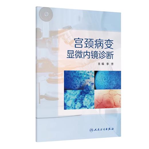 宫颈病变显微内镜诊断 商品图0