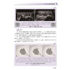 肌骨超声精粹90例 动态视频与多模态影像对照 林鸣琴 其中部分病例还提供超声动态视频，每个视频均附有讲解 科学技术文献出版社 商品缩略图4