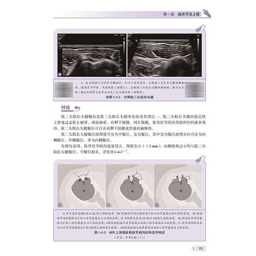 肌骨超声精粹90例 动态视频与多模态影像对照 林鸣琴 其中部分病例还提供超声动态视频，每个视频均附有讲解 科学技术文献出版社 商品图4