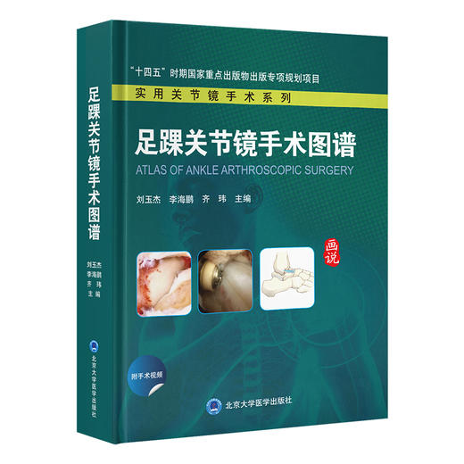 足踝关节镜手术图谱（实用关节镜手术系列）主编： 刘玉杰  李海鹏  齐 玮  北医社 商品图0