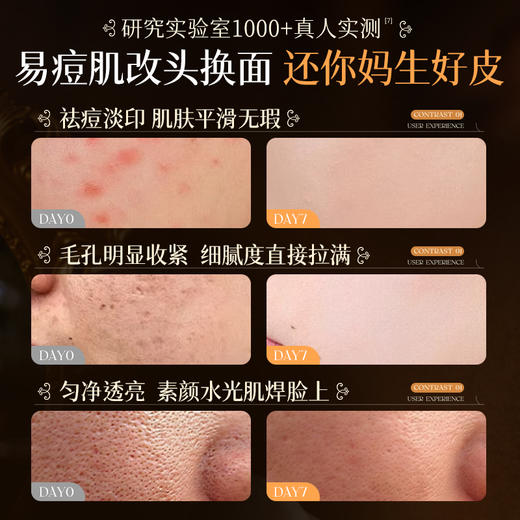 儒意水杨酸次抛精华液30支/盒 祛痘消印 次抛淡化收缩毛孔痘痘|儒意官方商城 商品图1