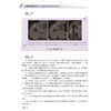 肌骨超声精粹90例 动态视频与多模态影像对照 林鸣琴 其中部分病例还提供超声动态视频，每个视频均附有讲解 科学技术文献出版社 商品缩略图3