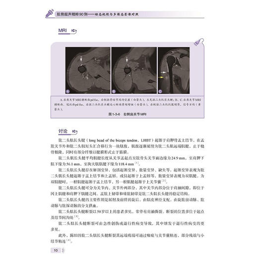 肌骨超声精粹90例 动态视频与多模态影像对照 林鸣琴 其中部分病例还提供超声动态视频，每个视频均附有讲解 科学技术文献出版社 商品图3