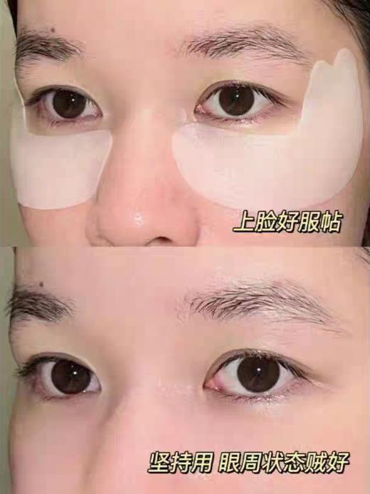 日本Spa treatment第四代红蛇毒眼膜exo蓝色蛇毒60枚 商品图9