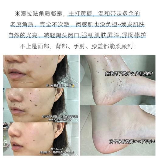 韩国MIORIO米澳拉黄糖去角质啫喱 清洁去死皮脸部洁面女男磨砂膏 商品图4