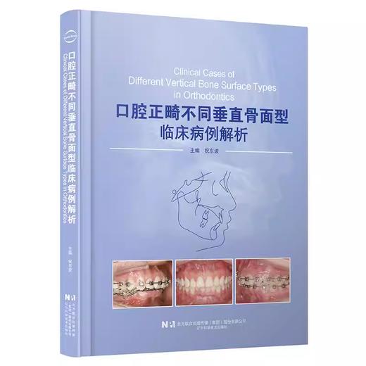 口腔正畸不同垂直骨面型临床病例解析 商品图0