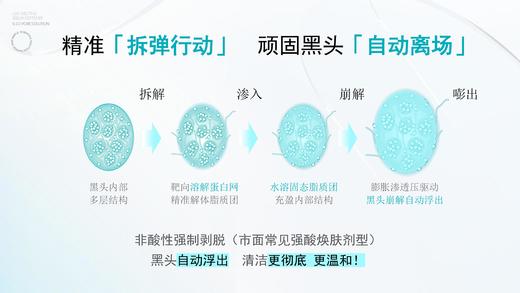 olive young爆款！+2.99还可以换购价值19.9的HelloKitty发圈  ilso一苏韩国进口黑头导出液去黑头水温和清洁150g 商品图7