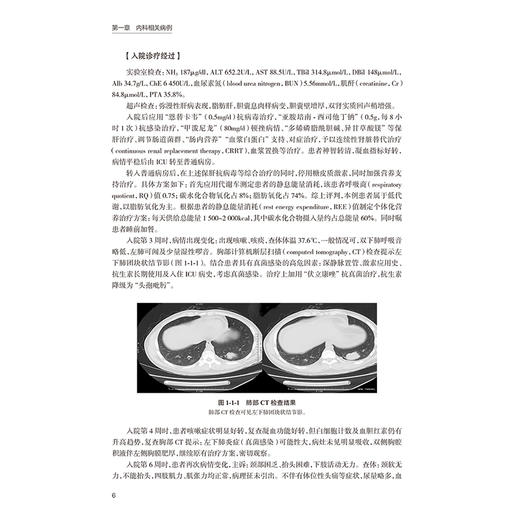肝病诊治病例精选 孟庆华 李娟 本书可用于住院医师规范化培训、专科进修学习，也可作为临床教学查房参考资料 人民卫生出版社 商品图4