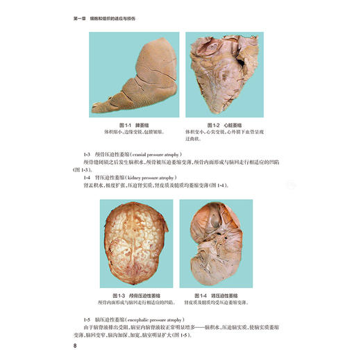 病理学实习指导 第3三版 十四五规划教材配套教材 全国高等学校配套教材 王医术 本科配教 临床医学 9787117388313 人民卫生出版社 商品图4