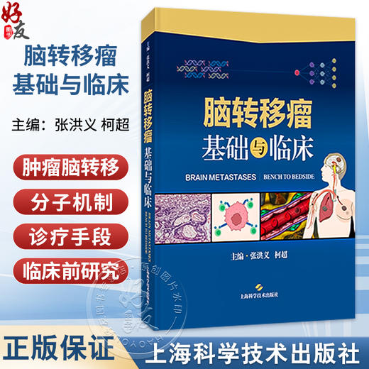 脑转移瘤：基础与临床 张洪义 柯超 主编 适用肿瘤学相关领域的临床医生和生物学、基础医学工作者 肿瘤学 上海科学技术出版社 商品图0