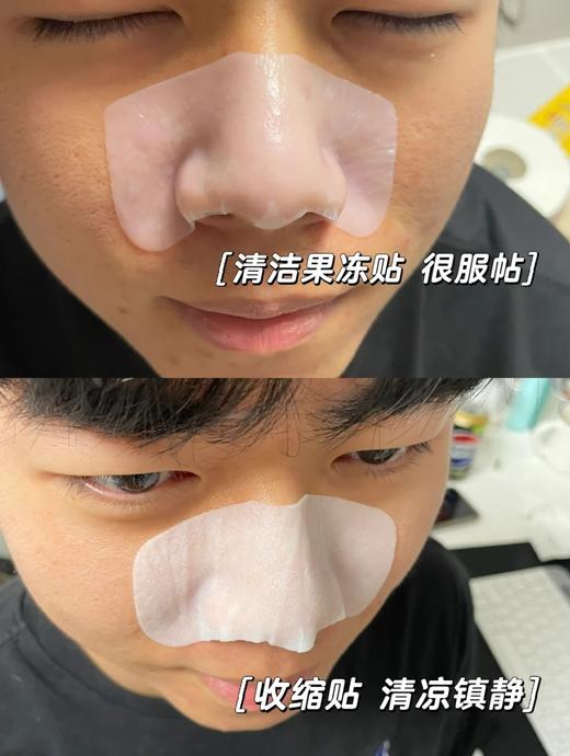 ilso一苏韩国进口去黑头鼻贴温和去粉刺深层清洁草莓鼻收缩毛孔 商品图4