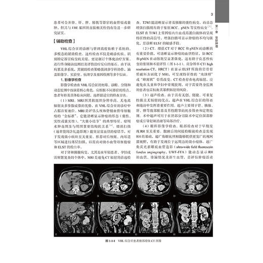 泌尿系统罕见病 罕见病系列丛书 龚侃 主编 全面介绍泌尿外科罕见病 泌尿系统疾病-罕见病-诊疗 9787565935633 北京大学医学出版社 商品图4