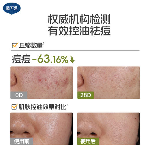 戴可思青少年冻膜平衡控油调理青春期祛痘涂抹面膜♥ 商品图3