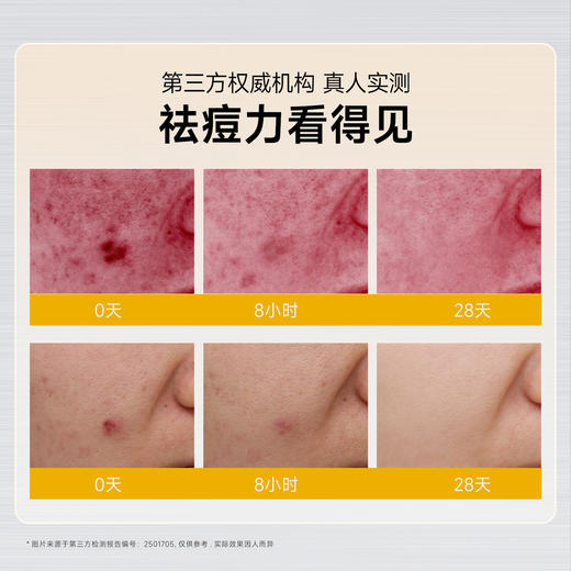 ⁴【一氪胶态硫祛痘精华液】含18%胶态硫 +依克多因+芽孢杆菌发酵物等 25ml/瓶 YC04-CR-YK 商品图5