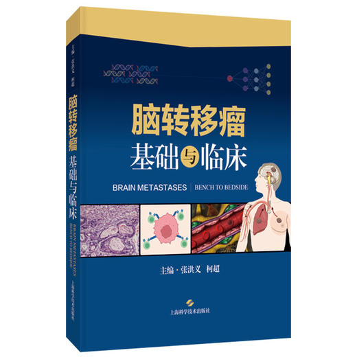 脑转移瘤：基础与临床 张洪义 柯超 主编 适用肿瘤学相关领域的临床医生和生物学、基础医学工作者 肿瘤学 上海科学技术出版社 商品图1