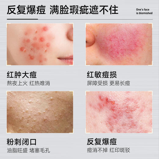 ⁴【一氪胶态硫祛痘精华液】含18%胶态硫 +依克多因+芽孢杆菌发酵物等 25ml/瓶 YC04-CR-YK 商品图1