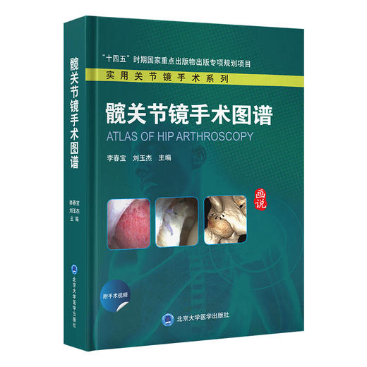 髋关节镜手术图谱   主编  李春宝  刘玉杰  北医出版 商品图0