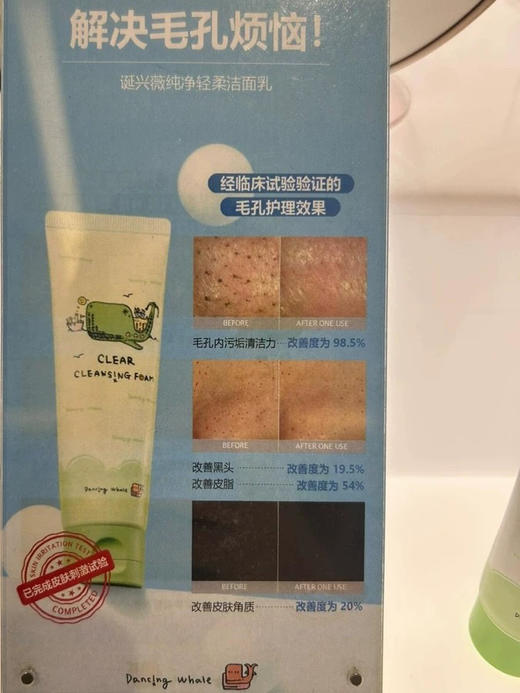 解决毛孔烦恼！韩国小鲸鱼净颜洁面乳温和洗面奶清洁护理敏感肌120ml 商品图2