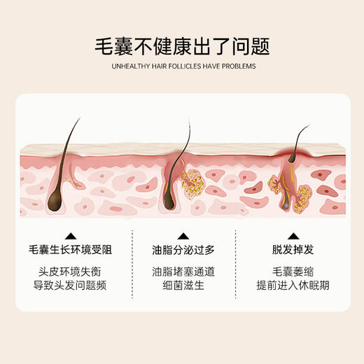 艾玛丝强韧防脱固发洗发水 商品图4