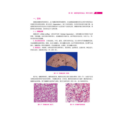 病理学与病理生理学 第2版 全国高职高专院校护理类专业核心教材(第二轮) 宋晓环 李宪孟 9787521455779 中国医药科技出版社 商品图4